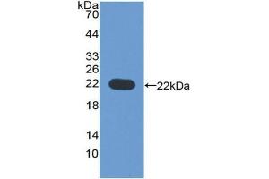 Detection of Recombinant CYP3A4, Human using Polyclonal Antibody to Cytochrome P450 3A4 (CYP3A4) (CYP3A4 anticorps  (AA 344-497))