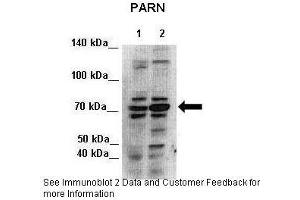 Lanes:   Lane 1: 7ug HEK293 cytoplasmic lysate  2: 7ug HEK293 nuclei lysate  Primary Antibody Dilution:   1:500  Secondary Antibody:   Anti-rabbit-HRP  Secondary Antibody Dilution:   1:500  Gene Name:   PARN  Submitted by:   Seiji Masuda, Kitashirakawa Oiwakecho, Kyoto University (PARN anticorps  (N-Term))