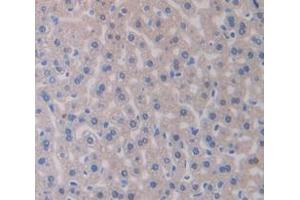 IHC-P analysis of Mouse Tissue, with DAB staining. (IRS1 anticorps  (AA 837-1089))