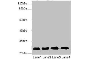 Western blot All lanes: CRIP2 antibody at 5. (CRIP2 anticorps  (AA 1-208))
