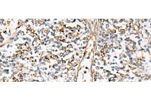 Immunohistochemistry of paraffin-embedded Human tonsil tissue using NPC2 Polyclonal Antibody at dilution of 1:80(x200) (NPC2 anticorps)