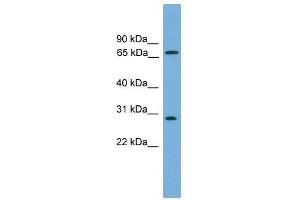 Western Blot showing SEMG2 antibody used at a concentration of 1-2 ug/ml to detect its target protein.