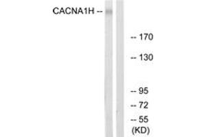 Western blot analysis of extracts from A549 cells, using CACNA1H Antibody. (CACNA1H anticorps  (AA 462-511))