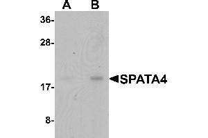 Western Blotting (WB) image for anti-Spermatogenesis Associated Protein 4 (SPATA4) (C-Term) antibody (ABIN1077367) (SPATA4 anticorps  (C-Term))