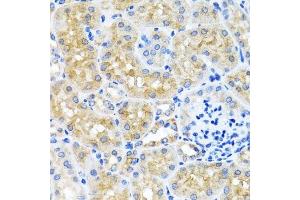 Immunohistochemistry of paraffin-embedded mouse kidney using SCO1 antibody.