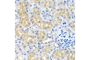 Immunohistochemistry of paraffin-embedded mouse kidney using SCO1 antibody. (SCO1 anticorps  (AA 1-160))