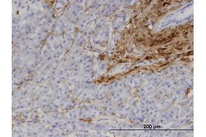 Immunoperoxidase of monoclonal antibody to COL1A1 on formalin-fixed paraffin-embedded human pancreas.