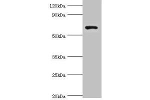 Western blot All lanes: Glutamate decarboxylase 1 antibody at 8 μg/mL + HepG2 whole cell lysate Secondary Goat polyclonal to rabbit IgG at 1/10000 dilution Predicted band size: 67, 26, 48 kDa Observed band size: 67 kDa (GAD anticorps  (AA 1-200))