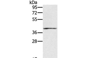 Western Blot analysis of Mouse muscle tissue using IFNGR2 Polyclonal Antibody at dilution of 1:200 (IFNGR2 anticorps)
