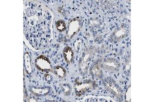 ABIN6266549 at 1/100 staining human kidney tissue sections by IHC-P. (GRIK1 anticorps  (Internal Region))