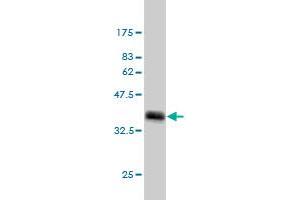 Western Blot detection against Immunogen (36. (MED1 anticorps  (AA 1391-1490))