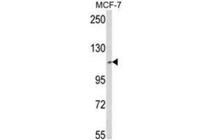 Western blot analysis of SKIV2L2 Antibody (Center) in MCF-7 cell line lysates (35ug/lane). (MTR4 anticorps  (Middle Region))