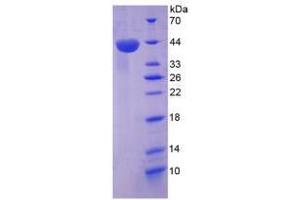 Image no. 1 for Chemokine (C-X-C Motif) Ligand 12 (CXCL12) (AA 23-89) (Active) protein (His tag,GST tag) (ABIN5665906)
