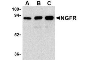Image no. 1 for anti-Nerve Growth Factor Receptor (NGFR) antibody (ABIN318704) (NGFR anticorps)