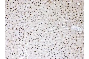 IHC testing of FFPE rat liver tissue with HMGB1 antibody at 1ug/ml.