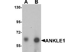 Western blot analysis of ANKLE1 in 293 cell lysate with ANKLE1 antibody at (A) 1 and (B) 2 µg/mL. (ANKLE1 anticorps  (C-Term))