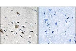 Immunohistochemistry analysis of paraffin-embedded human brain tissue, using MRPL52 Antibody.