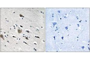 Immunohistochemistry analysis of paraffin-embedded human brain tissue, using MRPL52 Antibody.