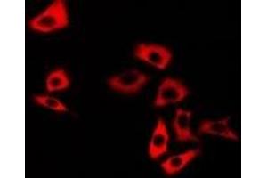 Immunofluorescent analysis of Calsarcin 1 staining in U2OS cells.
