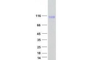 Validation with Western Blot