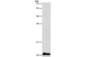 Western Blot analysis of Human fetal liver tissue using APOC1 Polyclonal Antibody at dilution of 1:500 (APOC1 anticorps)
