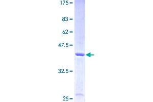 Fatty Acid Binding Protein 5 (Psoriasis-Associated) (FABP5) (AA 1-135) protein (GST tag)
