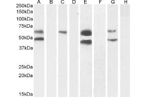 (ABIN570984) (1 μg/mL) staining of Human Cerebral Cortex (A) + peptide (B), (0. (CaMKII alpha/beta (Internal Region) anticorps)