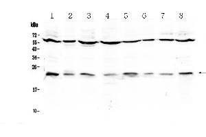 Western blot analysis of IL1RA using anti-IL1RA antibody .