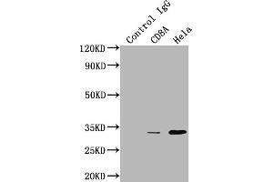 Immunoprecipitating CD8A in HepG2 whole cell lysate Lane 1: Rabbit control IgG instead of ABIN7127409 in HepG2 whole cell lysate.