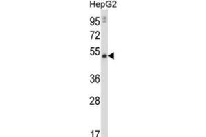 Western Blotting (WB) image for anti-Matrix Metalloproteinase 20 (MMP20) antibody (ABIN2997607)