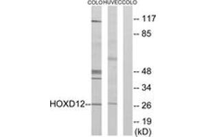 Western Blotting (WB) image for anti-Homeobox D12 (HOXD12) (AA 191-240) antibody (ABIN2889459) (HOXD12 anticorps  (AA 191-240))