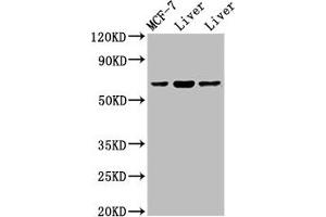 Western Blot Positive WB detected in: Rat liver tissue, Mouse liver issue All lanes: PTH1R antibody at 2 μg/mL Secondary Goat polyclonal to rabbit IgG at 1/50000 dilution Predicted band size: 67 kDa Observed band size: 67 kDa (PTH1R anticorps  (AA 485-593))