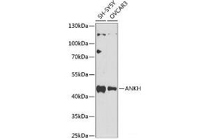 Western blot analysis of extracts of various cell lines using ANKH Polyclonal Antibody at dilution of 1:1000. (ANKH anticorps)