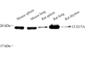 Western blot analysis of CLEC5A (ABIN7073250) at dilution of 1: 250