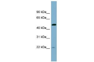 WB Suggested Anti-UCHL5IP Antibody Titration: 0. (HAUS7 anticorps  (Middle Region))
