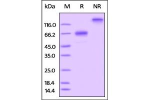 Rat OX40, Fc Tag on  under reducing (R) and ing (NR) conditions.