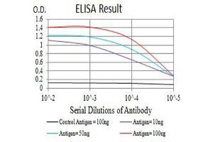 Black line: Control Antigen (100 ng),Purple line: Antigen (10 ng), Blue line: Antigen (50 ng), Red line:Antigen (100 ng) (PSMA anticorps  (AA 44-177))