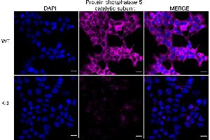Immunocytochemical staining of HeLa cells using Protein phosphatase 5 catalytic subunit antibody (ABIN7800030), 1:1,000), Top panel: wild-type (WT), Bottom panal: Protein phosphatase 5 catalytic subunit shRNA knockdown (KD).
