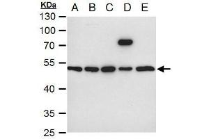 WB Image ILK antibody [N1C1] detects ILK protein by western blot analysis. (ILK anticorps)
