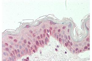 Rabbit Anti-RARG antibody  Formalin Fixed Paraffin Embedded Tissue: Human Skin Primary antibody Concentration: 1:100 Secondary Antibody: Donkey anti-Rabbit-Cy3 Secondary Antibody Concentration: 1:200 Magnification: 20x Exposure Time: 0.