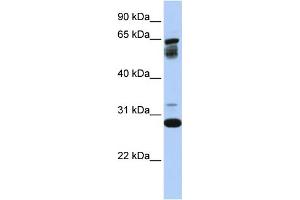 WB Suggested Anti-TMEM187  Antibody Titration: 0. (TMEM187 anticorps  (Middle Region))