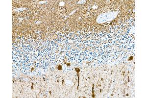 Immunohistochemistry (IHC) image for anti-Tubulin, beta 3 (TUBB3) (AA 400-450) antibody (ABIN7453957) (Recombinant TUBB3 anticorps  (AA 400-450))