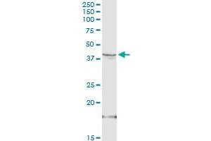 HSD3B1 MaxPab rabbit polyclonal antibody.
