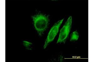 Immunofluorescence of monoclonal antibody to SPRY2 on HeLa cell.