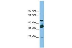 Image no. 1 for anti-G protein beta subunit-like (GBL) (C-Term) antibody (ABIN6745186)