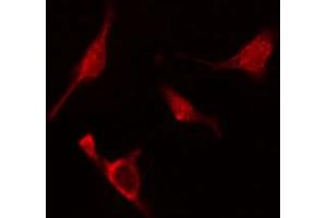 ABIN6274820 staining A549 cells by IF/ICC. (ARL2BP anticorps  (Internal Region))