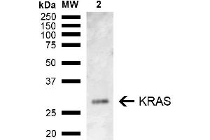 Western blot analysis of Rat Kidney showing detection of ~21. (K-RAS anticorps  (AA 100-189) (PE))