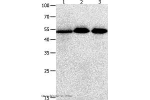 Western blot analysis of Human lymphoma , ovarian and  colon cancer tissue  , using KLF5 Polyclonal Antibody at dilution of 1:350 (KLF5 anticorps)