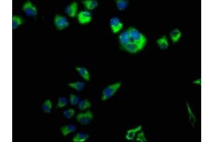 Immunofluorescence staining of Hela cells with ABIN7146593 at 1:50, counter-stained with DAPI. (Calsyntenin 3 anticorps  (AA 197-408))