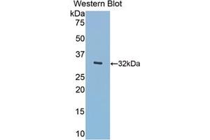Western blot analysis of the recombinant protein. (MGEA5 anticorps  (AA 319-450))